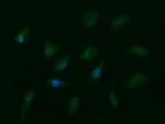 PTK2 Antibody in Immunocytochemistry (ICC/IF)