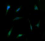 PTK2 Antibody in Immunocytochemistry (ICC/IF)