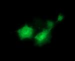 PTK2 Antibody in Immunocytochemistry (ICC/IF)