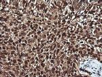 PTK2 Antibody in Immunohistochemistry (Paraffin) (IHC (P))