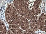 PTK2 Antibody in Immunohistochemistry (Paraffin) (IHC (P))