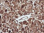 PTK2 Antibody in Immunohistochemistry (Paraffin) (IHC (P))