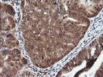 PTK2 Antibody in Immunohistochemistry (Paraffin) (IHC (P))