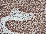 PTK2 Antibody in Immunohistochemistry (Paraffin) (IHC (P))