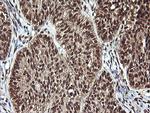 PTK2 Antibody in Immunohistochemistry (Paraffin) (IHC (P))