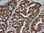 PTK2 Antibody in Immunohistochemistry (Paraffin) (IHC (P))