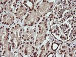 PTK2 Antibody in Immunohistochemistry (Paraffin) (IHC (P))