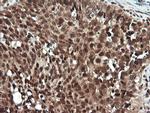 PTK2 Antibody in Immunohistochemistry (Paraffin) (IHC (P))