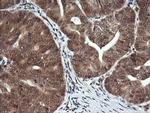 PTK2 Antibody in Immunohistochemistry (Paraffin) (IHC (P))