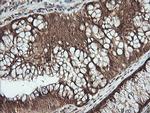 PTK2 Antibody in Immunohistochemistry (Paraffin) (IHC (P))