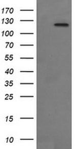 PTK2 Antibody in Western Blot (WB)