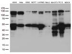 PTK2 Antibody in Western Blot (WB)