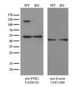 PTK2 Antibody in Western Blot (WB)