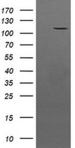 PTK7 Antibody in Western Blot (WB)