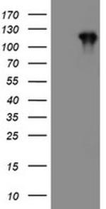 PTK7 Antibody in Western Blot (WB)