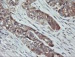 PTPN1 Antibody in Immunohistochemistry (Paraffin) (IHC (P))