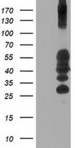 PTPN1 Antibody in Western Blot (WB)