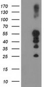 PTPN1 Antibody in Western Blot (WB)