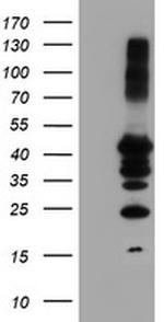 PTPN1 Antibody in Western Blot (WB)