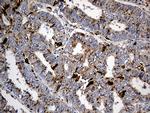 PTPN22 Antibody in Immunohistochemistry (Paraffin) (IHC (P))