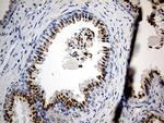 PTPN22 Antibody in Immunohistochemistry (Paraffin) (IHC (P))