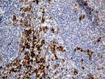 PTPN22 Antibody in Immunohistochemistry (Paraffin) (IHC (P))