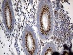 PTPN22 Antibody in Immunohistochemistry (Paraffin) (IHC (P))