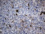 PTPN22 Antibody in Immunohistochemistry (Paraffin) (IHC (P))