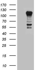 PTPN22 Antibody in Western Blot (WB)