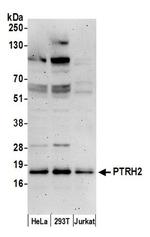 PTRH2/BIT1 Antibody in Western Blot (WB)