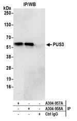 PUS3 Antibody in Immunoprecipitation (IP)