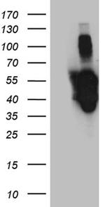 PXN Antibody in Western Blot (WB)