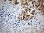 PYCR1 Antibody in Immunohistochemistry (Paraffin) (IHC (P))