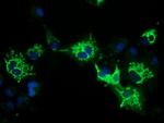 PYCR2 Antibody in Immunocytochemistry (ICC/IF)