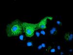 PYCR2 Antibody in Immunocytochemistry (ICC/IF)