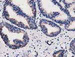 PYCR2 Antibody in Immunohistochemistry (Paraffin) (IHC (P))