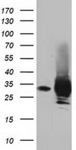 PYCR2 Antibody in Western Blot (WB)