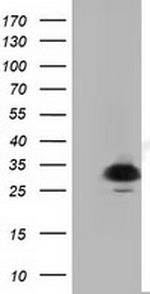 PYCR2 Antibody in Western Blot (WB)