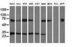 PYCR2 Antibody in Western Blot (WB)