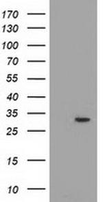 PYCR2 Antibody in Western Blot (WB)