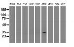 PYCR2 Antibody in Western Blot (WB)