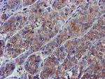 PYCRL Antibody in Immunohistochemistry (Paraffin) (IHC (P))