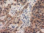 PYCRL Antibody in Immunohistochemistry (Paraffin) (IHC (P))