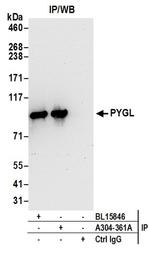 PYGL Antibody in Western Blot (WB)