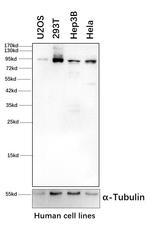 PYGL Antibody in Western Blot (WB)