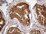 PYGM Antibody in Immunohistochemistry (Paraffin) (IHC (P))