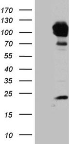 PYGM Antibody in Western Blot (WB)