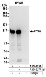 PYK2 Antibody in Western Blot (WB)