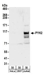 PYK2 Antibody in Western Blot (WB)