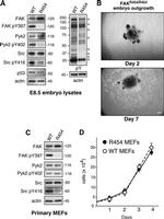 Phospho-PYK2 (Tyr402) Antibody in Western Blot (WB)